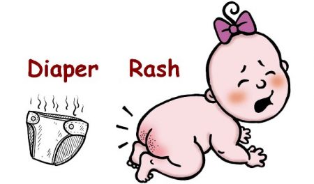 The Best Diaper Rash Cream [y] | Baby Bargains